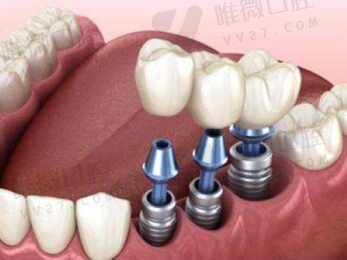 从体验到治疗:低价格也能提供“顺滑感”医疗体验