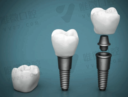 沈阳国民口腔门诊部怎么样?看这篇全知道,含价格、口碑等多维度揭秘