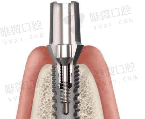 南充团圆口腔医院靠谱吗？是正规口腔机构，医生技术和服务口碑都不错
