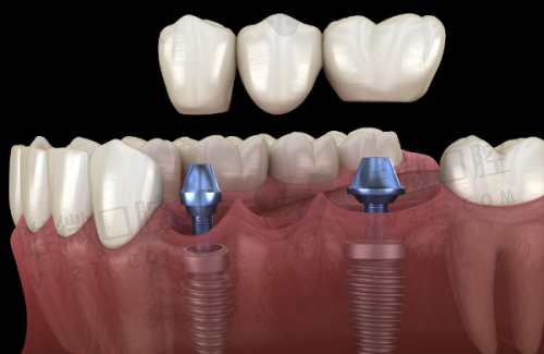 细挖牙牙乐“价格背后的模块组合玩法”