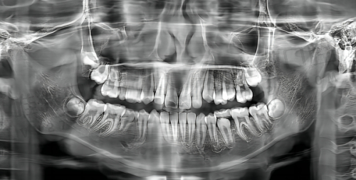 成都英博口腔医院种植牙怎么样？看亲民价格与高效流程能否让你心动！