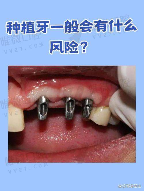 费用低但项目全:牙牙乐不是“低价陷阱”,而是“项目拼盘”