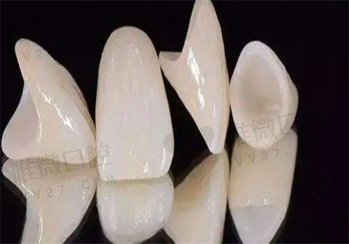 为何良心牙医不建议做全瓷牙？明明全瓷牙寿命是比较久的呐