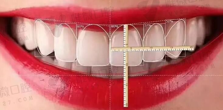 公开全瓷牙品牌十大排名及价格，秒懂400元一颗的全瓷牙好吗
