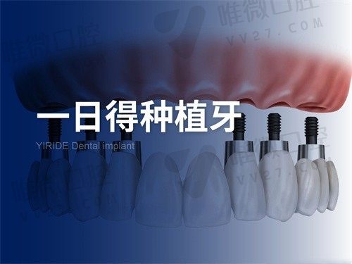 福州维乐口腔医院韩国登腾种植牙3480元起，舒适又坚固