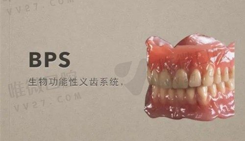 bps吸附性义齿是什么材料的？和活动义齿的区别？附收费价格