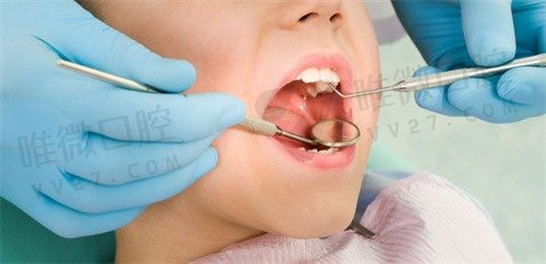 成都锦官口腔做儿童牙齿矫正超厉害，全麻治疗2小时仅3000起