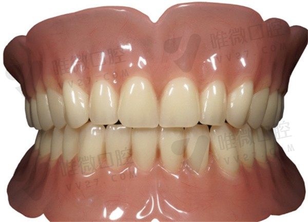 深度剖析吸附性义齿的优缺点，还有吸附性义齿收费价格也得了解