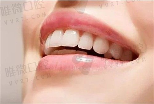 做六颗全瓷牙的个人经历分享给你，来看看全瓷牙的使用感受如何吧