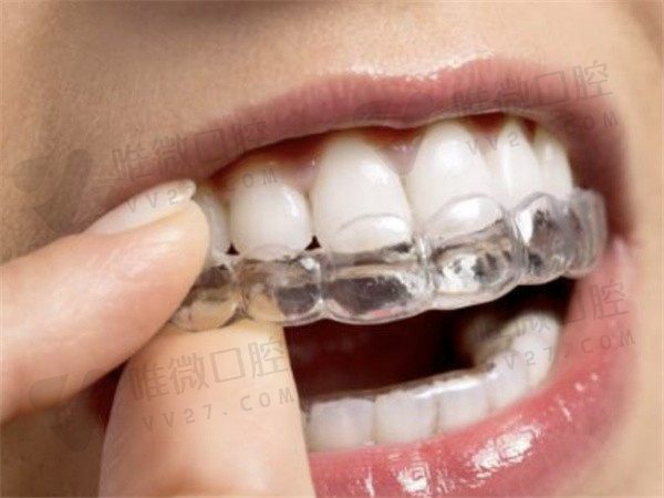 牙齿间距4mm可以做种植牙吗？本文告诉你缺失牙间隙太小怎么处理