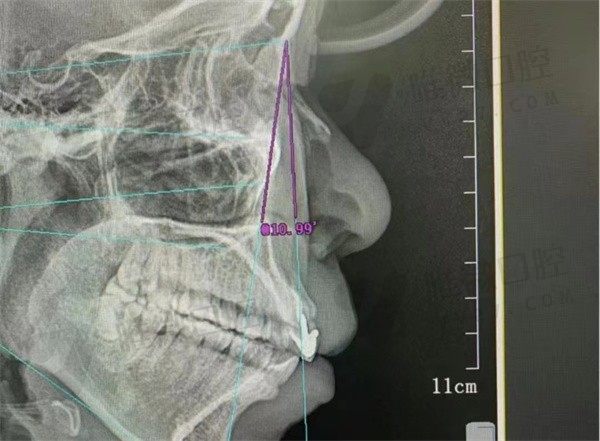 四医大口腔医院田磊怎么样？从简介看他做正颌好费用也不贵