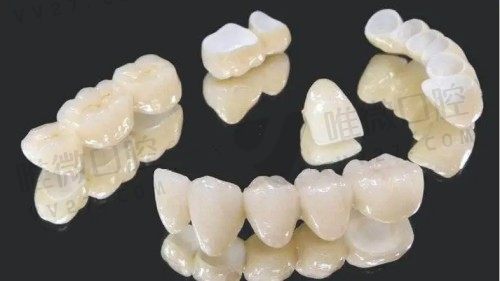 什么材质的牙冠可以做核磁共振?各种牙冠材质区别全面对比完就知道
