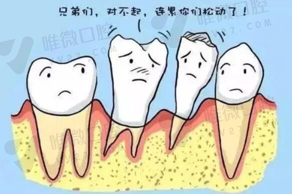 牙周炎引起的牙齿松动能固定吗?松动牙留不留的标准和方法及价格了解下