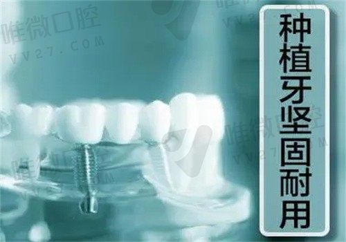 海南长林口腔医院种植牙技术出色，花了5W实现了牙齿健康
