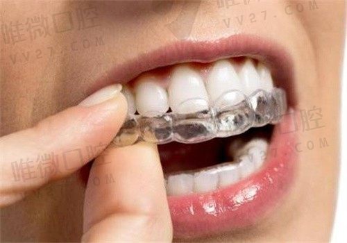 武汉博牙口腔医院价格表更新：有洗牙\补牙\拔牙\种植牙\牙齿矫正费用