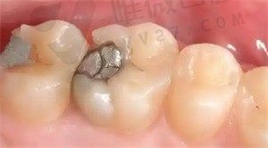 南平金贝口腔门诊部在哪里，位置在延平区八一路320号