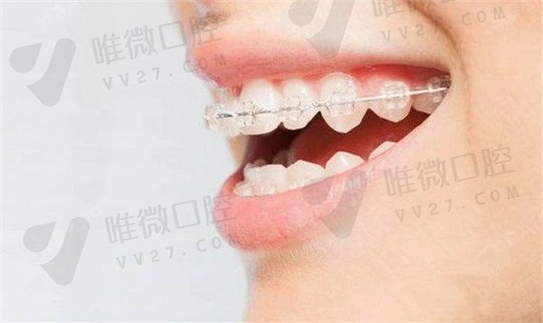 丽水人民医院矫正牙齿好不好？医院价格不贵，技术也值得选择