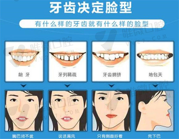 张丁院长牙齿矫正技术优势