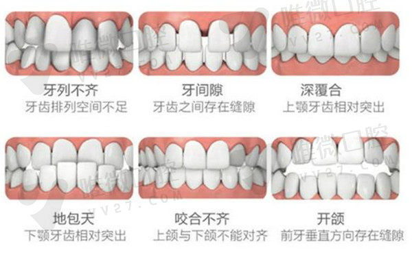 张丁院长能做的牙齿矫正项目