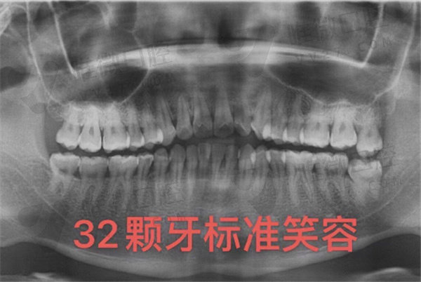 海口鼎点口腔牙齿矫正