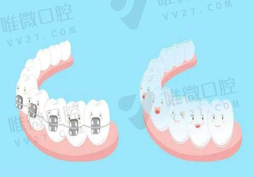 深圳同步齿科牙齿矫正怎么样？