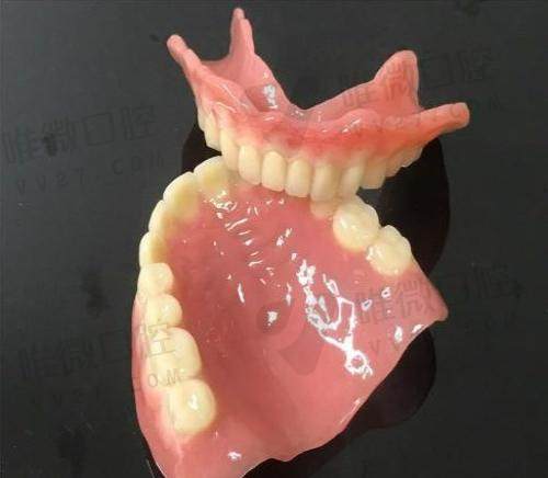 吸附性义齿有几种档次