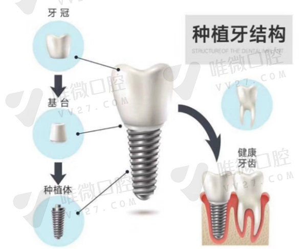 种牙价格调控新消息