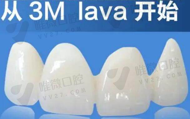 Lava全瓷牙收费