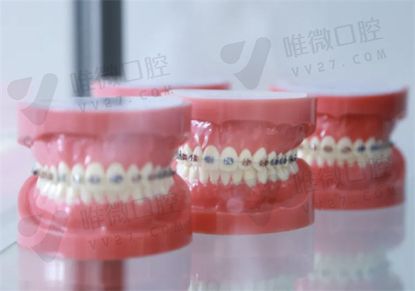 四川成都美莱整形口腔医院牙齿模型