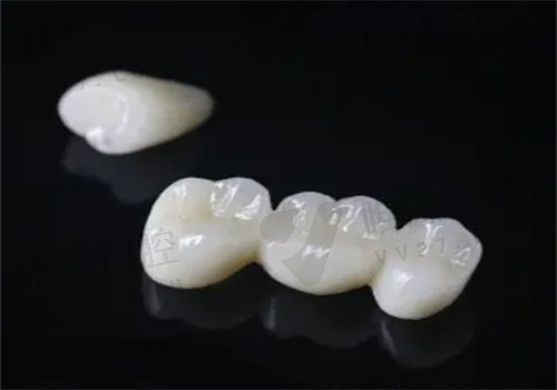 小诊所600一颗全瓷牙靠谱吗