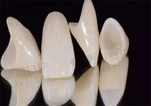 小诊所600一颗的全瓷牙通常是不可信