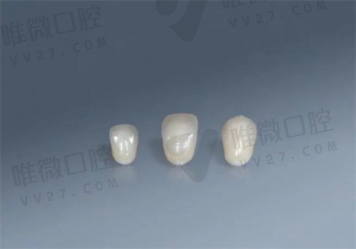 建议选择二氧化锆全瓷材料