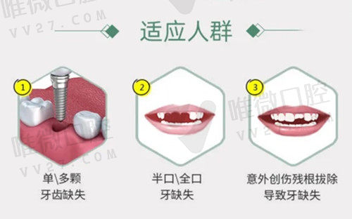 成都圣贝口腔