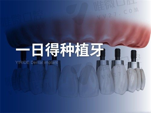 福州维乐口腔医院种植牙一日得