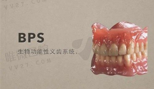 bps吸附性义齿是什么意思