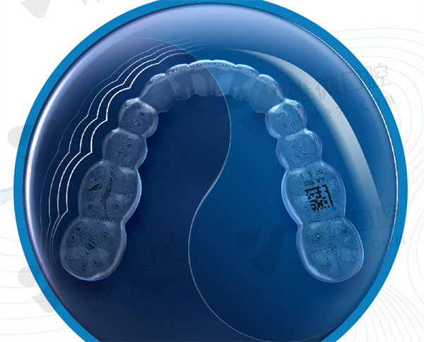 达芬奇隐形牙套和时代天使隐形牙套有什么区别