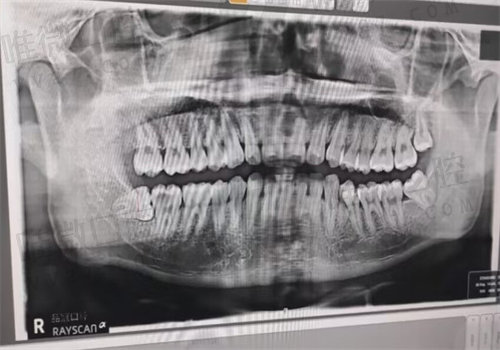 品冠口腔技术前沿