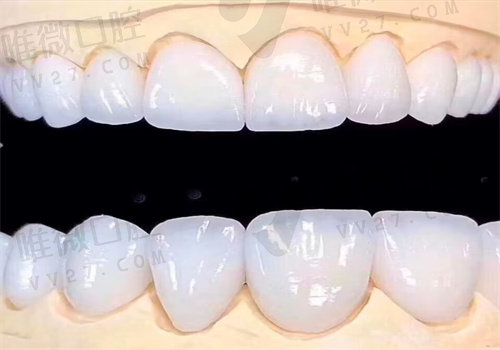 石家庄牙科医院收费标准