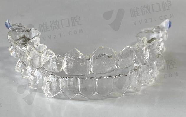 隐适美first矫正价格
