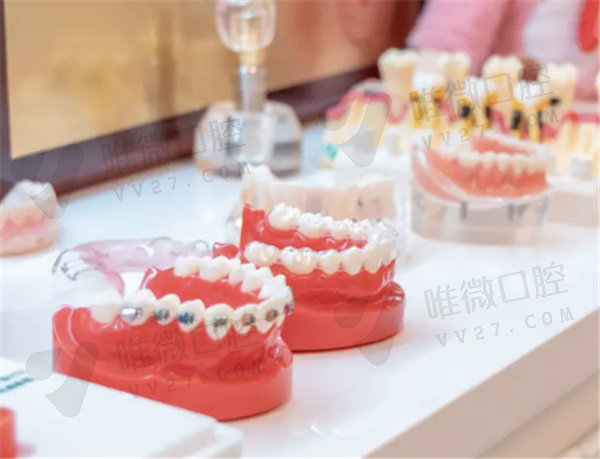 上海维乐口腔牙齿模型