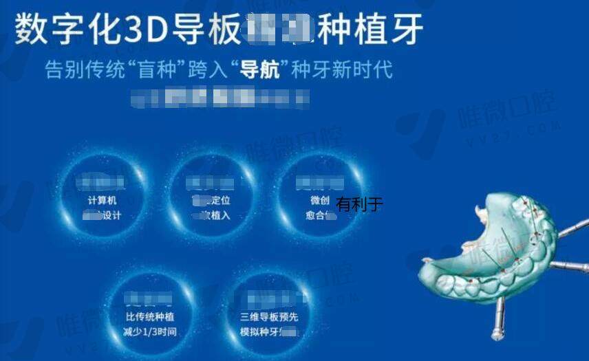 上海同济口腔医院种植牙技术好不好