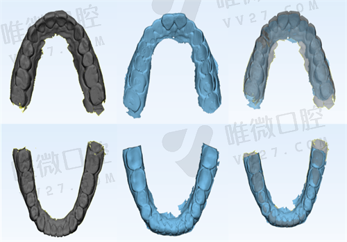 正雅S8S9颌位重建技术怎么样