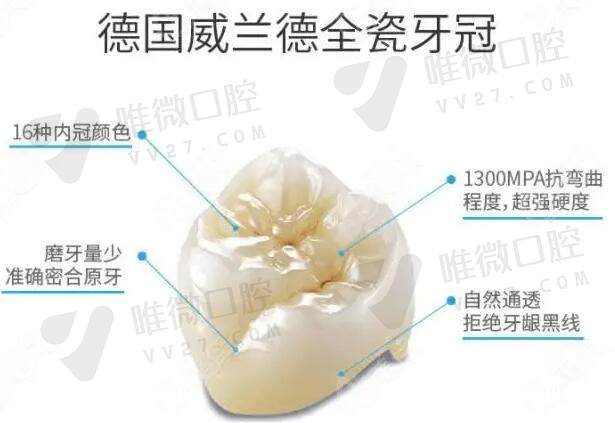 德国威兰德全瓷牙冠价格