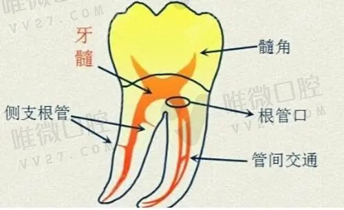 显微根管治疗需要几次