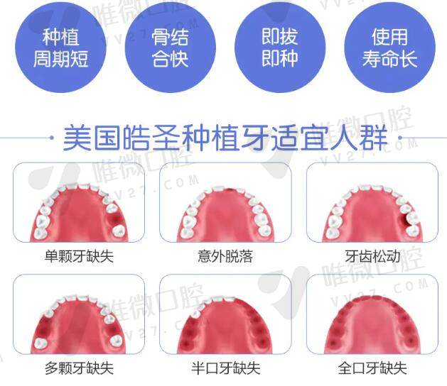 美国晧圣优缺点及价格