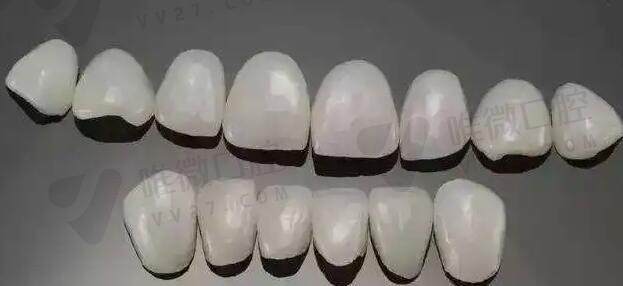 牙齿瓷贴面到底能够维持多久呢