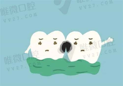 牙齿蛀空后光靠补牙有用吗？