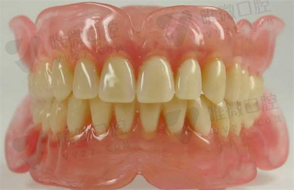 普通全口义齿牙的优缺点