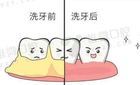 牙齿无缘无故出血是什么原因