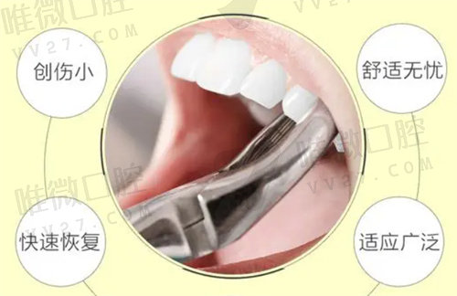 超声骨刀拔牙和普通拔牙的区别